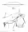 Fig. 02 - Contoured needle support device