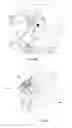 Fig. 06 - Door opening prevention device in broadside collision of vehicle