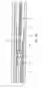 Fig. 20 - SLIDER WINDOW ASSEMBLY WITH CABLE GUIDES
