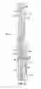 Fig. 04 - Safety valve, downhole system having safety valve, and method