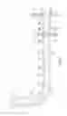 Fig. 02 - Downhole apparatus and method