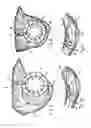 Fig. 06 - Filter device, in particular for gas filtration