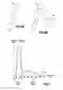 Fig. 04 - Preoperative lighting device