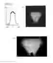 Fig. 35 - Illumination device