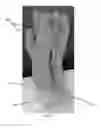 Fig. 06 - Support System