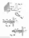 Fig. 04 - Apparatus for prevention of dropping of handgun