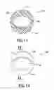 Fig. 07 - Density phase separation device