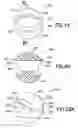 Fig. 11 - Density phase separation device
