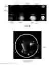 Fig. 08 - Scalable liposome microarray screening