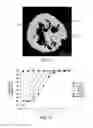 Fig. 09 - Scalable liposome microarray screening