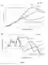 Fig. 07 - Quantitative Interpretation of Cell Index Profiles