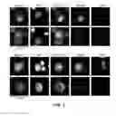 Fig. 02 - Capture, identification and use of a new biomarker of solid tumors in body fluids