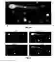 Fig. 05 - Capture, identification and use of a new biomarker of solid tumors in body fluids