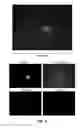 Fig. 06 - Capture, identification and use of a new biomarker of solid tumors in body fluids