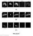 Fig. 09 - Capture, identification and use of a new biomarker of solid tumors in body fluids