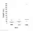 Fig. 12 - Capture, identification and use of a new biomarker of solid tumors in body fluids
