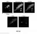 Fig. 25 - Capture, identification and use of a new biomarker of solid tumors in body fluids