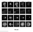 Fig. 28 - Capture, identification and use of a new biomarker of solid tumors in body fluids