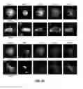 Fig. 29 - Capture, identification and use of a new biomarker of solid tumors in body fluids