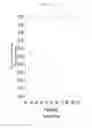 Fig. 12 - Methods And Marker Combinations For Screening For Predisposition To Lung Cancer