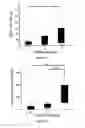 Fig. 03 - Methods and kits for determining whether a patient with cirrhosis is at risk of having clinically significant portal hypertension