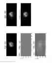 Fig. 08 - Magnetic resonance imaging apparatus and method of operating the same