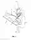 Fig. 02 - SURGICAL MICROSCOPE AND A RETROFITTING SET FOR A SURGICAL MICROSCOPE
