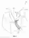 Fig. 09 - Automatic method for milling complex channel-shaped cavities