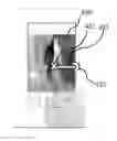 Fig. 01 - Processing an infrared (IR) image based on swipe gestures
