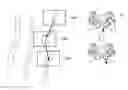 Fig. 01 - Information processing apparatus and method to move a display area of a needle biopsy image