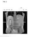 Fig. 05 - Graphical user interface for medical instruments