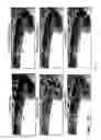 Fig. 06 - Automated epithelial nuclei segmentation for computational disease detection algorithms