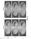 Fig. 06 - Image reconstruction in interleaved multi-energy imaging