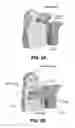 Fig. 03 - Portable power tool with trigger switch, trigger release and lock-on mechanism combination
