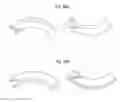 Fig. 03 - STRAIN CONTROL FOR ACCELERATION OF EPITAXIAL LIFT-OFF