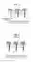 Fig. 07 - Image sensor having a plurality of phototransistors separated by trench-gate structures and method of manufacturing the same