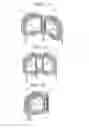 Fig. 07 - Rotary electric machine and manufacturing method therefor