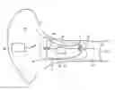 Fig. 01 - METHOD OF DETERMINING A FIT OF A HEARING DEVICE AND HEARING DEVICE WITH FIT RECOGNITION