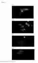 Fig. 02 - MOUSE MODEL OF AMYOTROPHIC LATERAL SCLEROSIS AND/OR FRONTOTEMPORAL LOBAR DEGENERATION