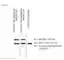 Fig. 05 - MOUSE MODEL OF AMYOTROPHIC LATERAL SCLEROSIS AND/OR FRONTOTEMPORAL LOBAR DEGENERATION