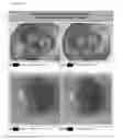 Fig. 10 - METHOD AND APPARATUS FOR THE AMPLIFICATION OF ELECTRICAL CHARGES IN BIOLOGICAL SYSTEMS OR BIOACTIVE MATTER USING AN INDUCTIVE DISK WITH A FIXED GEOMETRIC TRACE