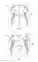 Fig. 05 - Lining mounted inflatable protector and protective clothing assembly