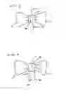 Fig. 02 - Bowtie construction