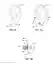 Fig. 09 - IMPLANTABLE AND MAGNETIC RETENTION SYSTEM FOR REMOVABLE ATTACHMENT OF JEWELRY, ORNAMENTS AND OTHER WEARABLE FIXTURES