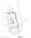 Fig. 06 - Apparatus And Methods For Carrying Electronic Devices