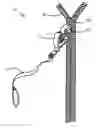 Fig. 01 - ZIPPER ASSIST DEVICE AND METHOD