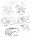 Fig. 08 - Apparatus, systems, and methods for epicardial imaging and injection