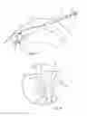 Fig. 09 - Apparatus, systems, and methods for epicardial imaging and injection