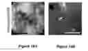 Fig. 16 - Rotational scanning endoscope