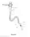 Fig. 02 - Method and Device for Improved Hygiene During Endoscopic Procedures